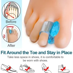 1 Pair Blue Soft Silicone Gel Toe Separator Hallux Valgus Bunion Spacers Thumb Corrector Foot Care Tool