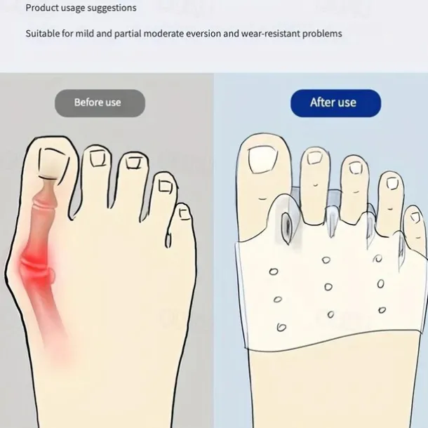 1 Pair Hallux Valgus Corrector, Toe Separators Toe Spacers Split Toe Device, Five Toes Forefoot Pad, Silicone Wearable Shoes for Women