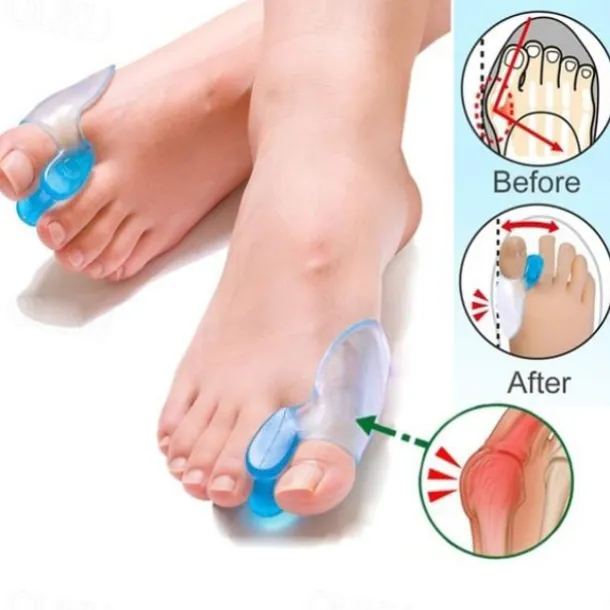 2 Pieces Big Toe Separator Bone Corrector Straightener Silicone Gel Foot Fingers Protector Bunion Adjuster Feet Massager