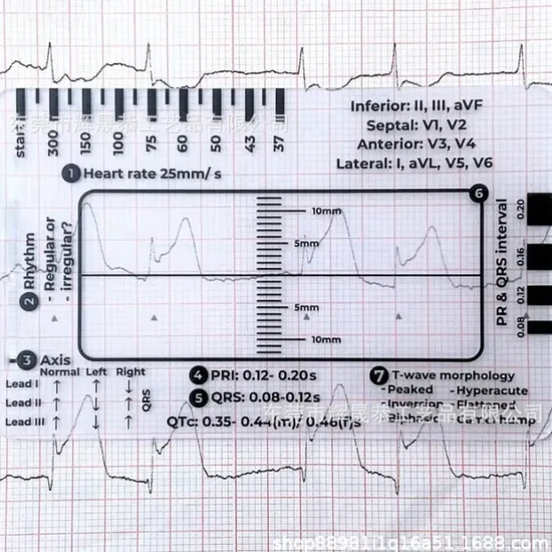 ECG 7 Step Ruler, ECG Ruler Plastic Ruler Measuring Tool, ECG 7 Step Ruler for ECG/EKG Interpretation, Transparent EKG Calipers Measuring Tool, Follow a 7 Step Plan