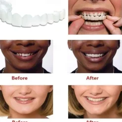 1Pack Silicone Teeth Whitening Teeth Cover Teeth Braces Simulation Denture Upper Teeth Lower Teeth Set with Box Perfect Smile