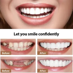 1Pack Silicone Teeth Whitening Teeth Cover Teeth Braces Simulation Denture Upper Teeth Lower Teeth Set with Box Perfect Smile