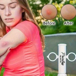 1pc Vacuum Venom Extractor, Mosquito and Bee Sting Suction Tool, Outdoor Survival Emergency Kit, Venom Extraction Pump for Snake Bites