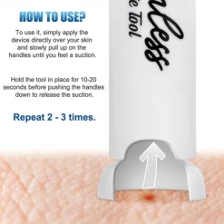 1pc Vacuum Venom Extractor, Mosquito and Bee Sting Suction Tool, Outdoor Survival Emergency Kit, Venom Extraction Pump for Snake Bites