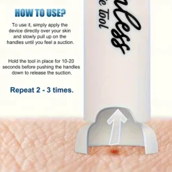 1pc Vacuum Venom Extractor, Mosquito and Bee Sting Suction Tool, Outdoor Survival Emergency Kit, Venom Extraction Pump for Snake Bites