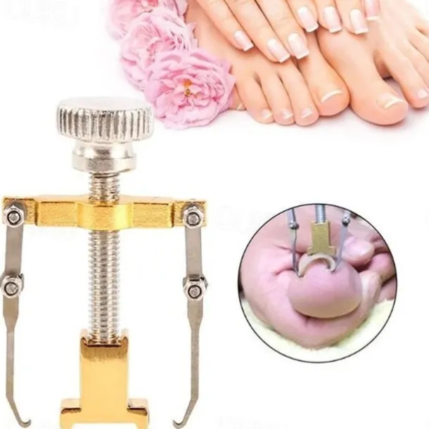 2Pcs Ingrown Toenails Corrector Stainless Steel Nail Straightening Tool Relief Pain Pedicure Tool For Ingrown Toenail Recover