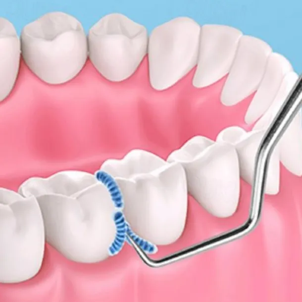 7Pcs Portable Stainless Steel Toothpicks Pocket Set Reusable Metal Toothpicks Cleaning Kit with Holder for Outdoor Picnic Camping Traveling