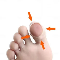 2PCS Silicone Ingrown Toenail Corrector – Invisible Toe Nail Straightening Brace, Pedicure Foot Care Tool for Paronychia Treatment & Nail Healing Protection