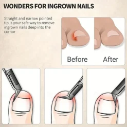 Stainless Steel Toenail Clippers with Sharp Pointed Tip for Ingrown and Thick Nails - Wide Jaw Podiatry Care Tool