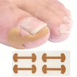 Toenail Correction Patches - 10 Sheets of Ingrown Nail Correction Bone Patch, 40pcs/set Toenail Correction Patches